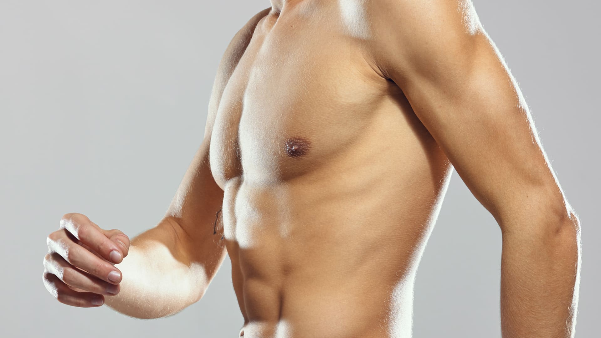 Gynecomastia