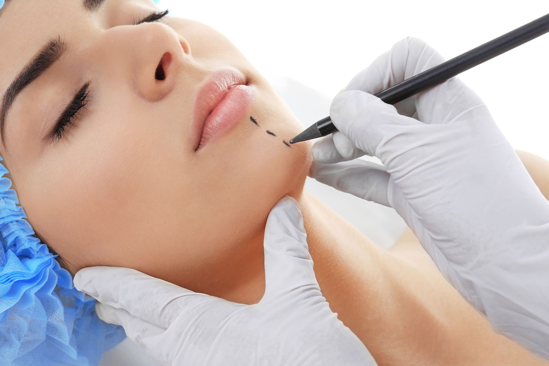 CHIN AUGMENTATION