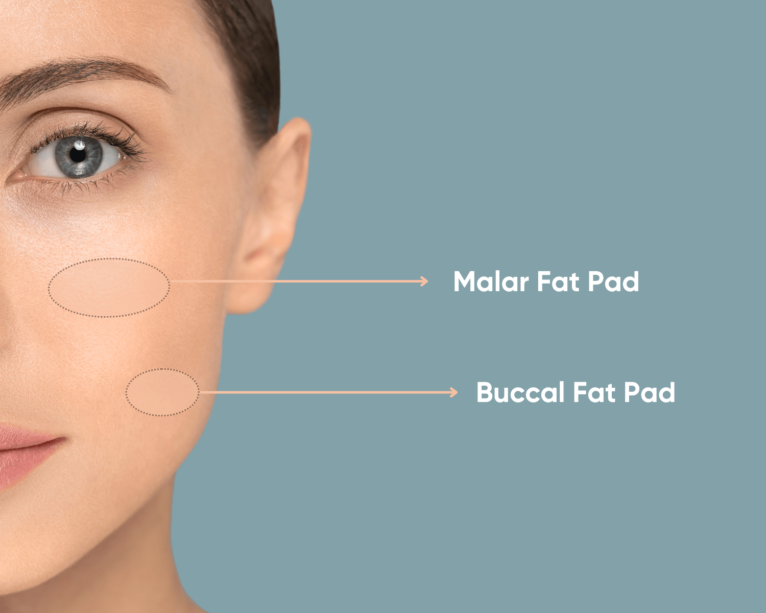 ανατομία προσώπου για το buccal fat pad